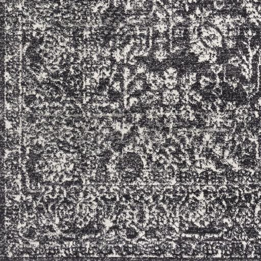 Surya Harput HAP-1028 Black Charcoal 2'7" x 7'3" Rug